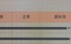 体重管理年|超重/肥胖的定义、判定与原因